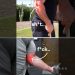 Elbow pain relief